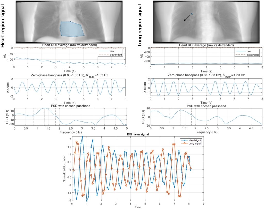 4D CT-based long perfusion – Laboratory for Flow Imaging & Diagnostics