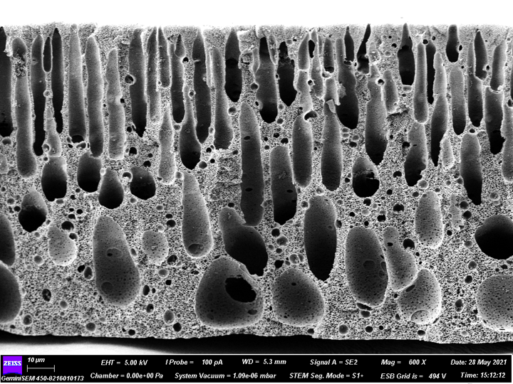 Scanning Electron Microscope – Electron Microscope Center